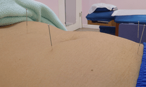 gallery-2